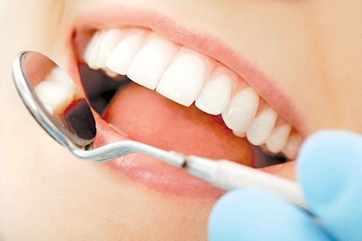 Bọc răng sứ cải thiện hoạt động nhai.
