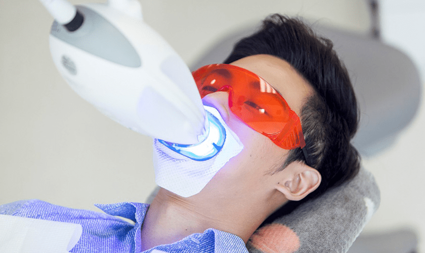 Trường hợp nào không nên áp dụng phương pháp tẩy trắng răng