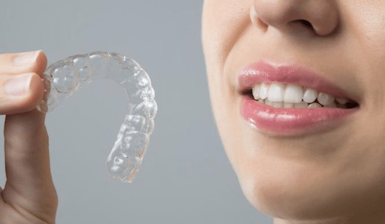Tẩy trắng răng tại Thuỷ Nguyên sử dụng máng Plastic