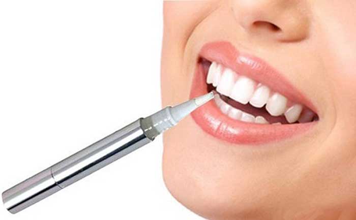 Quy trình tẩy trắng răng tại tiên lãng như thế nào?