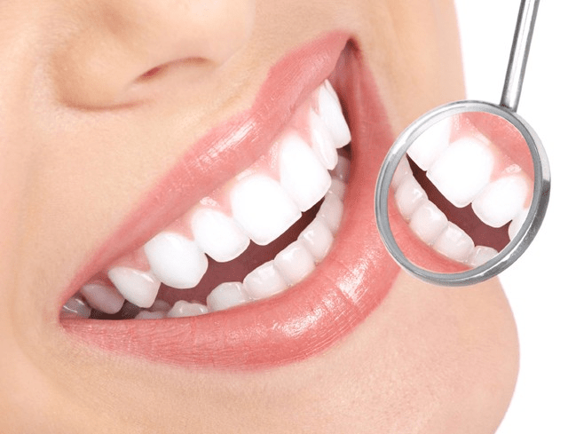 Tẩy trắng răng tại Ngô Quyền để có hàm răng trắng khỏe