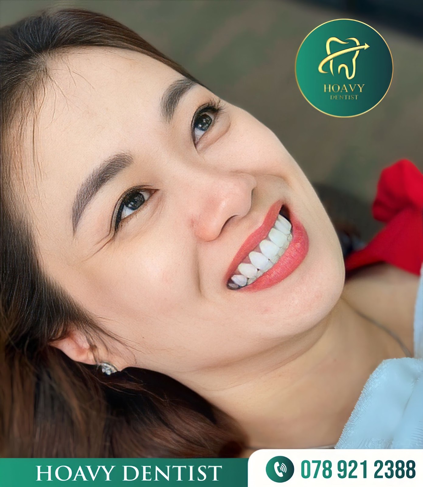 Tẩy trắng răng không ê buốt là mục tiêu của rất nhiều khách hàng khi tìm kiếm dịch vụ làm trắng răng